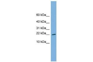 RPS13 antibody used at 1 ug/ml to detect target protein. (RPS13 anticorps  (Middle Region))