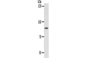 Gel: 8 % SDS-PAGE, Lysate: 40 μg, Lane: Hela cells, Primary antibody: ABIN7189809(ANKRD28 Antibody) at dilution 1/1050, Secondary antibody: Goat anti rabbit IgG at 1/8000 dilution, Exposure time: 2 hours (ANKRD28 anticorps)