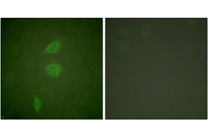 Immunofluorescence analysis of NIH/3T3 cells, using HDAC5 antibody (ABIN5976423).