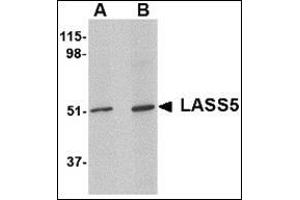 Western blot analysis of LASS5 in SK-N-SH lysate with this product at (A) 1 and (B) 2 μg/ml. (LASS5 anticorps  (N-Term))
