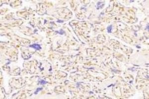 Immunohistochemistry analysis of paraffin-embedded human placenta using,PTGFR (ABIN7075209) at dilution of 1: 800