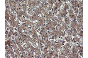 Immunohistochemical staining of paraffin-embedded Human liver tissue using anti-TBCC mouse monoclonal antibody. (TBCC anticorps)