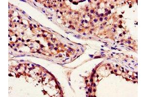 Immunohistochemistry of paraffin-embedded human testis tissue using ABIN7145318 at dilution of 1:100 (BCL2A1 anticorps  (AA 1-175))