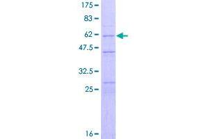 Image no. 1 for Caspase 2, Apoptosis-Related Cysteine Peptidase (CASP2) (AA 1-452) protein (GST tag) (ABIN1348097)