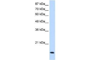 WB Suggested Anti-MYC Antibody Titration:  1. (c-MYC anticorps  (N-Term))