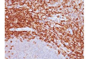Formalin-fixed, paraffin-embedded human spleen stained with CD43 Mouse Monoclonal Antibody (DF-T1). (CD43 anticorps)