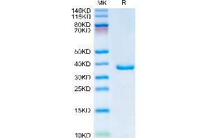 Human IGFBP2 on Tris-Bis PAGE under reduced condition.