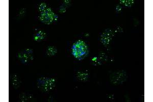 Image no. 7 for anti-Amyloid beta (A4) Precursor Protein (APP) antibody (ABIN1496876) (APP anticorps)