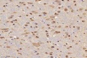 Immunohistochemistry analysis of paraffin-embedded mouse brain using,ABCA7 (ABIN7073146) at dilution of 1: 3000 (ABCA7 anticorps)