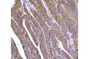 IHC analysis of CTNND1 using anti-CTNND1 antibody (ABIN7602220). (CTNND1 anticorps  (AA 64-930))