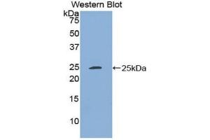 Detection of Recombinant SDF4, Rat using Polyclonal Antibody to Stromal Cell Derived Factor 4 (SDF4)