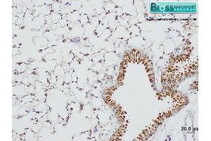 Formalin-fixed and paraffin embedded mouse lung tissue labeled Anti-SP-D Polyclonal Antibody, Unconjugated at 1:2000, followed by conjugation to the secondary antibody and DAB staining