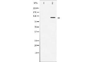 Western blot analysis of Trk A phosphorylation expression in starved treated Jurkat whole cell lysates,The lane on the left is treated with the antigen-specific peptide.