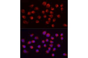 Immunofluorescence analysis of Neuro-2a using ENO2 Rabbit mAb (ABIN7266959) at dilution of 1:100 (40x lens).