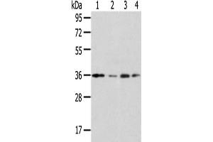 Western Blotting (WB) image for anti-Homeobox D13 (HOXD13) antibody (ABIN5961463)