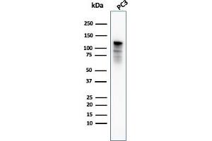 Western Blot Analysis of PC3 cell lysate using Drebrin-1 Mouse Monoclonal Antibody (DBN1/3393). (DBN1 anticorps  (AA 150-281))