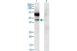 Western Blot analysis of CSF2RA expression in transfected 293T cell line by CSF2RA monoclonal antibody (M03), clone 2G5. (CSF2RA anticorps  (AA 1-400))