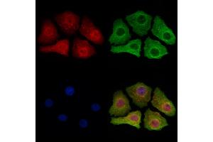 ABIN6265191 and ABIN6273164 staining Hela cells by IF/ICC.