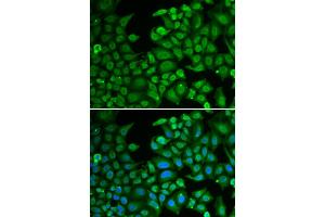 Immunofluorescence analysis of MCF-7 cell using RBFOX3 antibody. (NeuN anticorps)