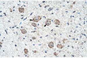 Immunohistochemical staining (Formalin-fixed paraffin-embedded sections) of human brain with KLHL25 polyclonal antibody . (KLHL25 anticorps  (AA 163-212))
