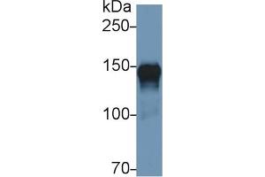 Detection of ORP150 in Human Lung lysate using Polyclonal Antibody to 150 kDa Oxygen Regulated Protein (ORP150) (150 kDa Oxygen Regulated Protein (AA 695-994) anticorps)
