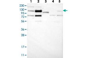 Western blot analysis of Lane 1: RT-4, Lane 2: U-251 MG, Lane 3: Human Plasma, Lane 4: Liver, Lane 5: Tonsil with ZNF592 polyclonal antibody .