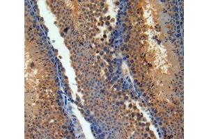 IHC-P analysis of Brain tissue, with DAB staining.