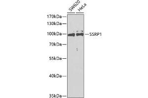 Western blot analysis of extracts of various cell lines, using SSRP1 antibody (ABIN6129536, ABIN6148492, ABIN6148494 and ABIN6217711) at 1:400 dilution. (SSRP1 anticorps  (AA 1-300))