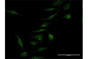 Immunofluorescence of purified MaxPab antibody to MINA on HeLa cell. (MINA anticorps  (AA 1-465))