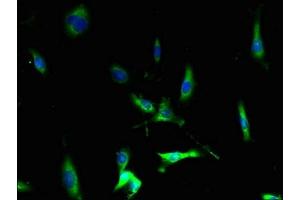 Immunofluorescent analysis of U251 cells using ABIN7145914 at dilution of 1:100 and Alexa Fluor 488-congugated AffiniPure Goat Anti-Rabbit IgG(H+L)