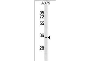 ITM2C anticorps  (N-Term)