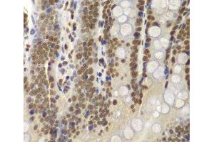Immunohistochemistry of paraffin-embedded Rat Intestine using SMARCB1 Polyclonal Antibody at dilution of 1:200 (40x lens).