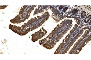 IHC analysis of delta 1 Catenin/CAS/CTNND1 using anti-delta 1 Catenin/CAS/CTNND1 antibody (ABIN7602221). (CTNND1 anticorps  (AA 64-930))