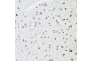 Immunohistochemistry of paraffin-embedded mouse brain using MAPK3 Antibody.
