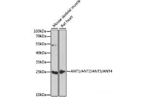 Western blot analysis of extracts of various cell lines using ANT1/ANT2/ANT3/ANT4 Polyclonal Antibody at dilution of 1:1000. (ANT1+ANT2+ANT3+ANT4 anticorps)