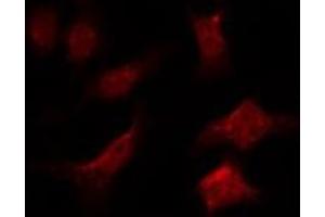 ABIN6275992 staining 293T by IF/ICC. (FZD6 anticorps  (C-Term))