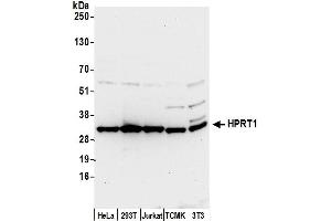 Western Blotting (WB) image for anti-Hypoxanthine phosphoribosyltransferase 1 (HPRT1) (AA 168-218) antibody (ABIN7450341)