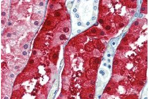 Human Kidney: Formalin-Fixed, Paraffin-Embedded (FFPE)