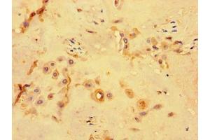 Immunohistochemistry of paraffin-embedded human placenta tissue using ABIN7163828 at dilution of 1:100 (PKD1L3 anticorps  (AA 22-194))