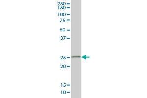Western Blotting (WB) image for anti-Cell Death-Inducing DFFA-Like Effector B (CIDEB) (AA 3-111) antibody (ABIN599215) (CIDEB anticorps  (AA 3-111))