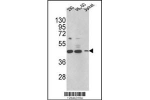 Western blot analysis of HSD17B7 Antibody in 293,HL-60,Jurkat cell line lysates (35ug/lane)(2ug/ml)