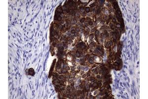 Immunohistochemistry (IHC) image for anti-Keratin Acidic (AE1) antibody (ABIN2715666)