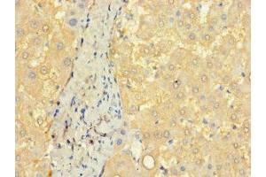 Immunohistochemistry of paraffin-embedded human liver tissue using ABIN7148140 at dilution of 1:100 (CCDC68 anticorps  (AA 131-335))