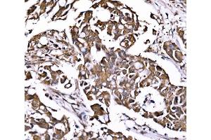IHC analysis of PSMD8 using anti-PSMD8 antibody (ABIN7602571).