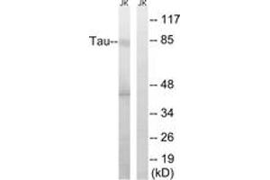 Western blot analysis of extracts from Jurkat cells, using Tau (Ab-519/202) Antibody. (tau anticorps  (AA 266-315))