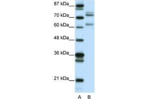 Western Blotting (WB) image for anti-GATA Zinc Finger Domain Containing 2B (GATAD2B) antibody (ABIN2460620) (GATAD2B anticorps)