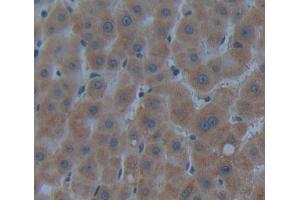 IHC-P analysis of Kidney tissue, with DAB staining. (CROT anticorps  (AA 410-612))
