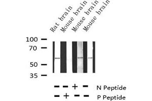Western blot analysis of Phospho-Tyrosine Hydroxylase (Ser31) expression in various lysates