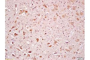 Formalin-fixed and paraffin embedded rat brain labeled with Anti-Rsk2 Polyclonal Antibody, Unconjugated (ABIN700720) at 1:200 followed by conjugation to the secondary antibody and DAB staining