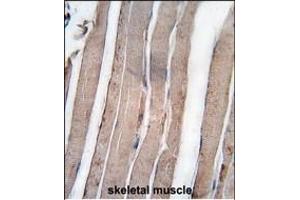 Formalin-fixed and paraffin-embedded human skeletal muscle tissue reacted with DK1 antibody (C-term) 7217b , which was peroxidase-conjugated to the secondary antibody, followed by DAB staining. (DAP Kinase 1 anticorps  (C-Term))